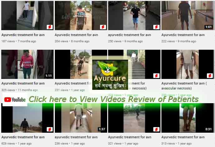 Patient video reviews for ayurvedic treatment for avn
